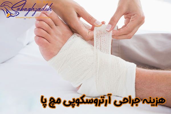 هزینه آرتروسکوپی مچ پا