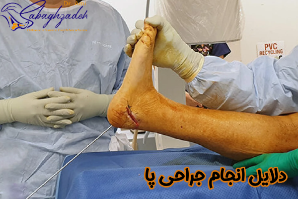 دلایل انجام جراحی پا
