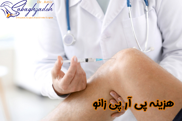 هزینه پی آر پی زانو