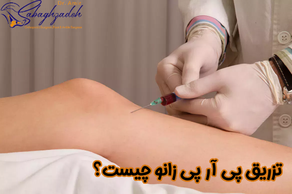 تزریق پی آر پی زانو چیست