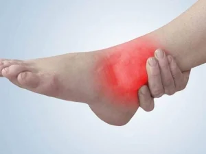 تاندونیت آشیل