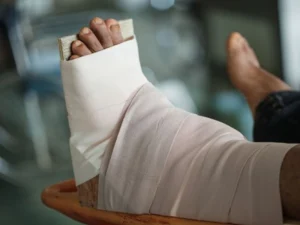 جراحی تعویض مفصل مچ پا