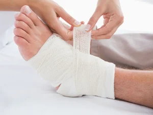 مراقبت بعد از آرتروسکوپی مچ پا