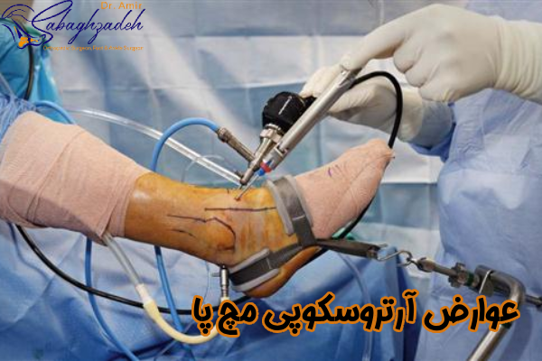 عوارض آرتروسکوپی مچ پا چیست