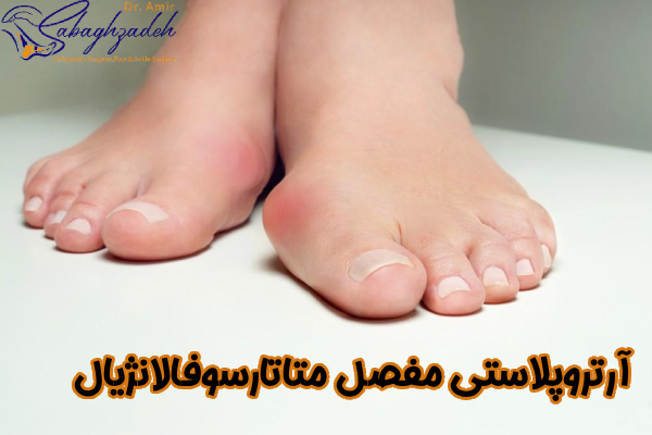 آرتروپلاستی مفصل متاتارسوفالانژیال