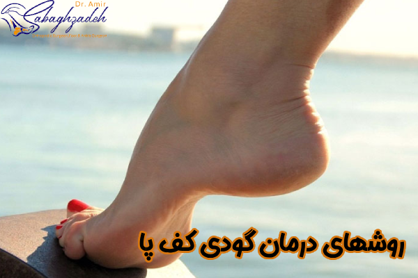 روشهای درمان گودی کف پا