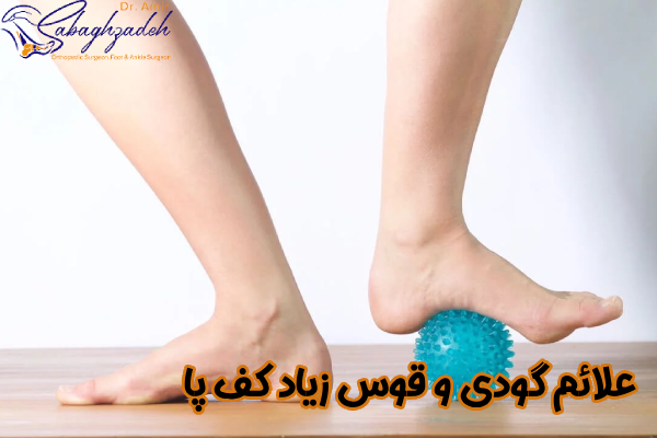 علائم گودی کف پا