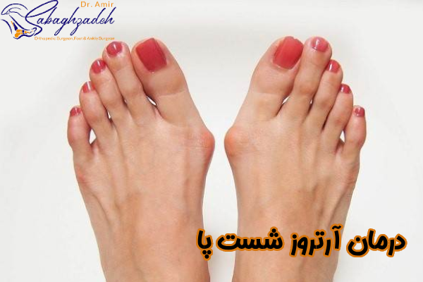 درمان آرتروز شست پا چیست