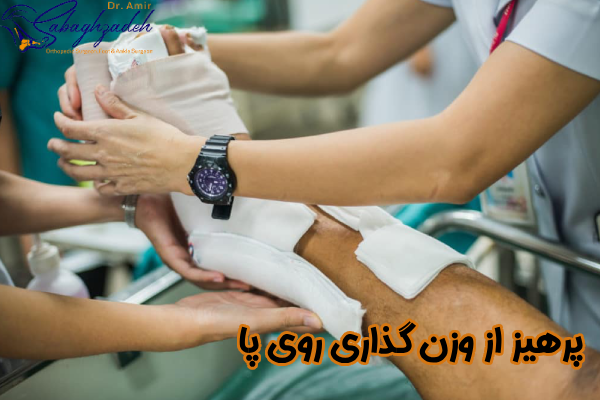 پرهیز از وزن گذاری روی پا