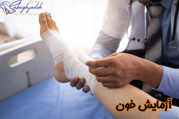 آزمایش خون شکستگی پا
