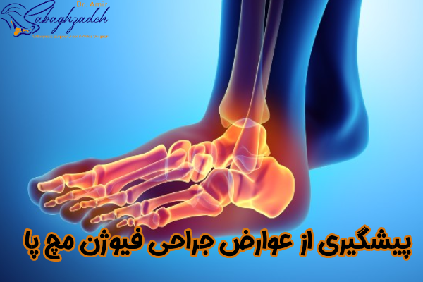 پیشگیری از عوارض فیوژن مچ پا