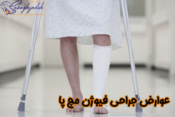 خطرات جراحی فیوژن مچ پا