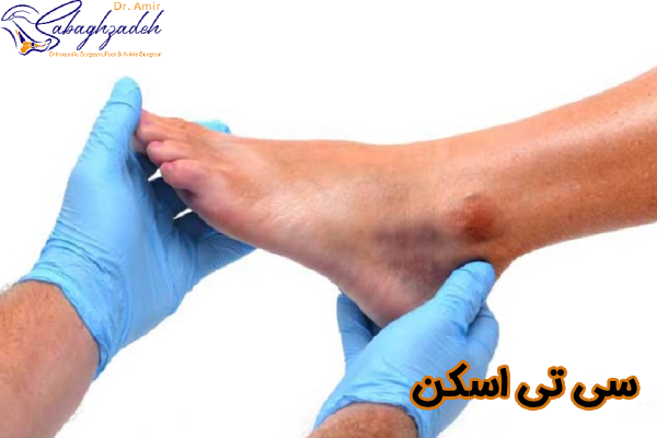 سی تی اسکن سیاه شدگی
