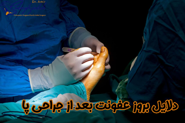 دلایل بروز عفونت بعد از جراحی پا