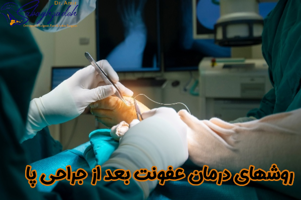 روش های درمان عفونت بعد از جراحی پا