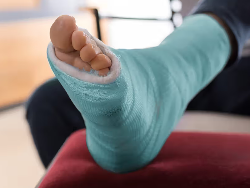 مراقبت های بعد از تعویض مفصل مچ پا