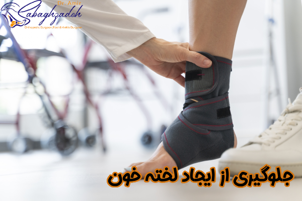 جلوگیری از ایجاد لخته خون