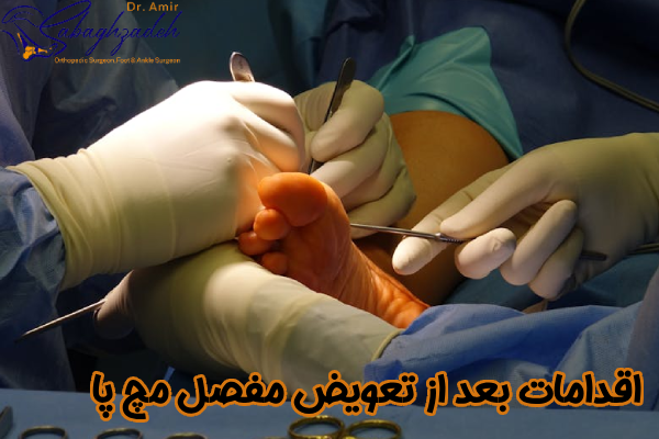 اقدامات بعد از تعویض مفصل مچ پا