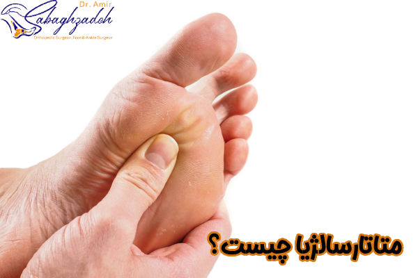 متاتارسالژیا چیست