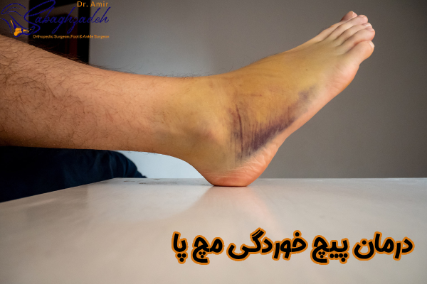 درمان پیچ خوردگی مچ پا چیست