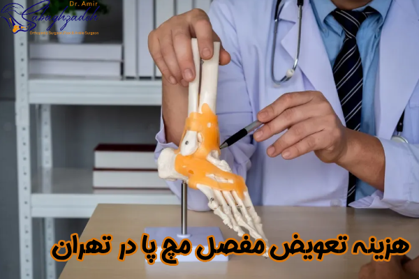 هزینه تعویض مفصل مچ پا در تهران