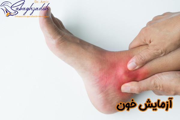 آزمایش خون