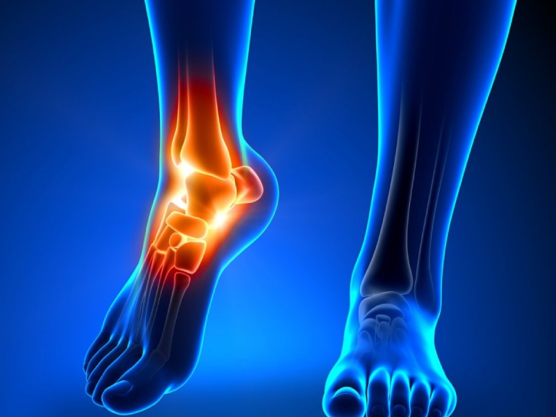 عوارض تعویض مفصل مچ پا
