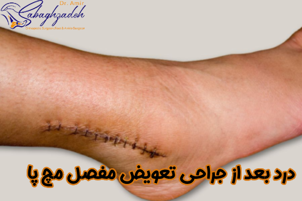 درد بعد از جراحی تعویض مفصل مچ پا