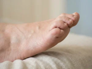 دفورمیتی پای دیابتی